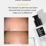 Cosrx BHA Blackhead Power Liquid 100ml - Image 4