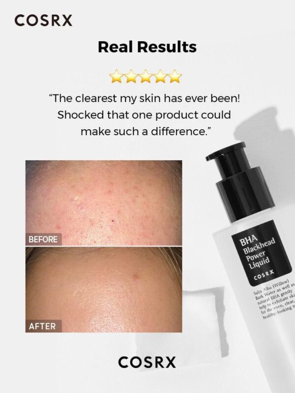 Cosrx BHA Blackhead Power Liquid 100ml - Image 4