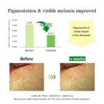 Dr. Althea Gentle Vitamin C serum 30ml - Image 7